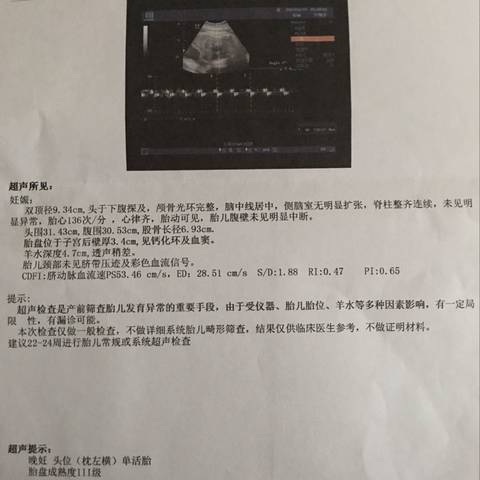 journal_insert_pic_700308366