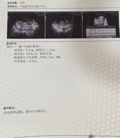 journal_insert_pic_700827165