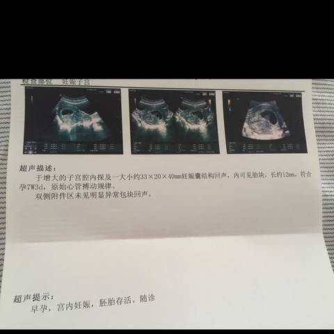 journal_insert_pic_702479944