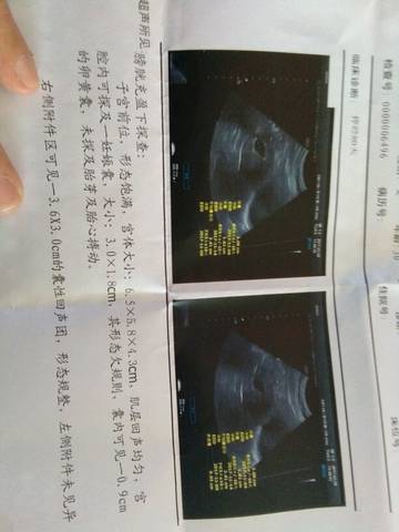 journal_insert_pic_703099430