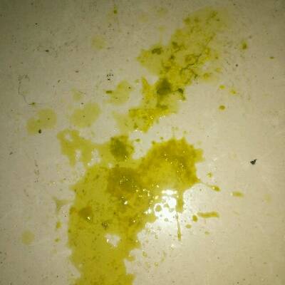 三个月 19天的宝宝大便拉水都一个星期了,吃了蒙脱石散和妈咪爱不见