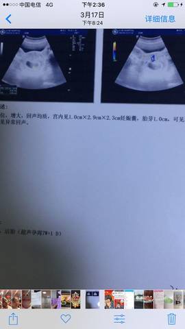 journal_insert_pic_704702239