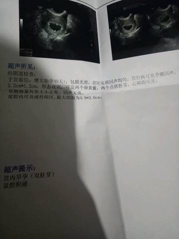 journal_insert_pic_705624977