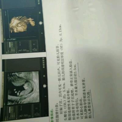 journal_insert_pic_705512541