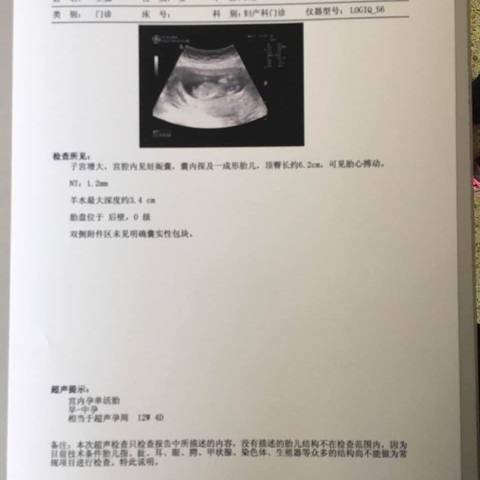 journal_insert_pic_706086793