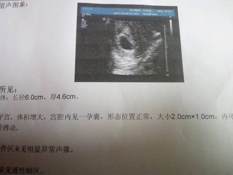 journal_insert_pic_708555931