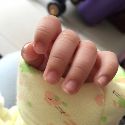 宝宝40天了,手指甲根部皮肤有点发黑,之前没有,最近才有