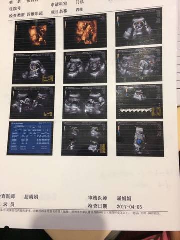 journal_insert_pic_710435924