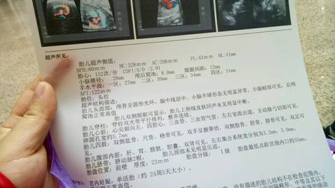 journal_insert_pic_709913948