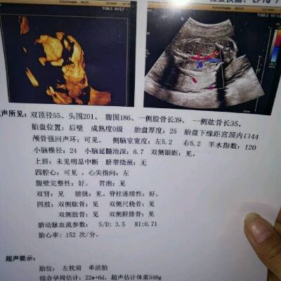 journal_insert_pic_710171628