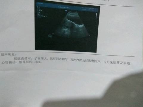 journal_insert_pic_710450859