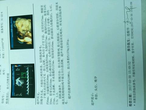 journal_insert_pic_710798030