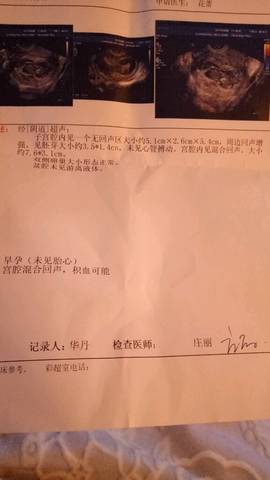 journal_insert_pic_711247396