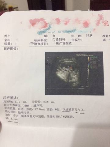 journal_insert_pic_711925235