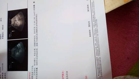 journal_insert_pic_711933138