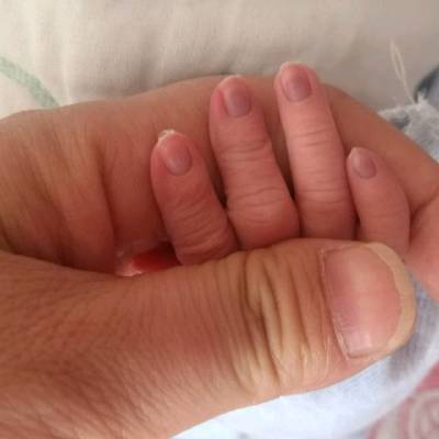 刚出生的宝宝指甲发紫是怎麼回事?