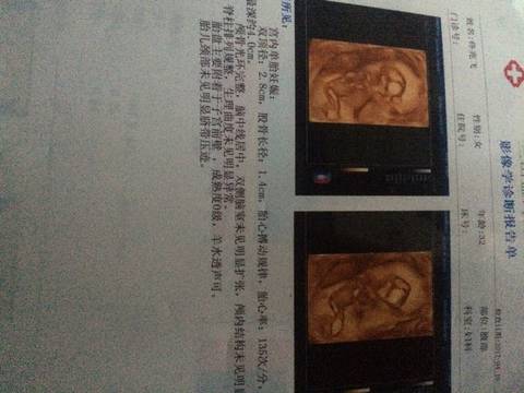 journal_insert_pic_715924061