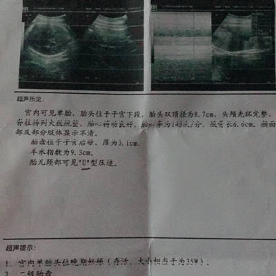 journal_insert_pic_716381819