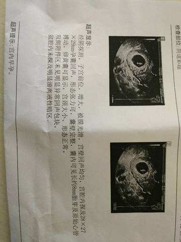 journal_insert_pic_716297509