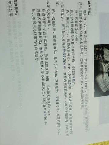 journal_insert_pic_718761869