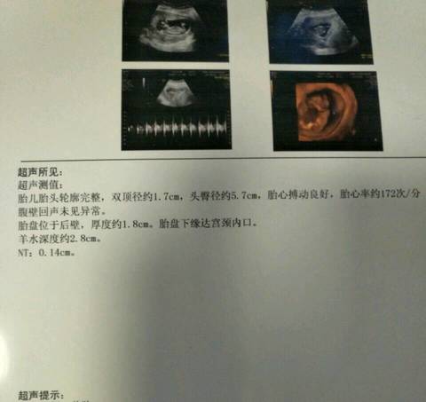 journal_insert_pic_720505835