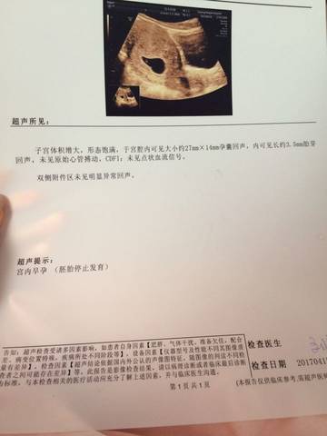journal_insert_pic_720224709