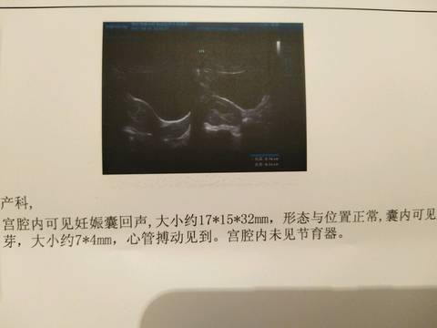 journal_insert_pic_722086808