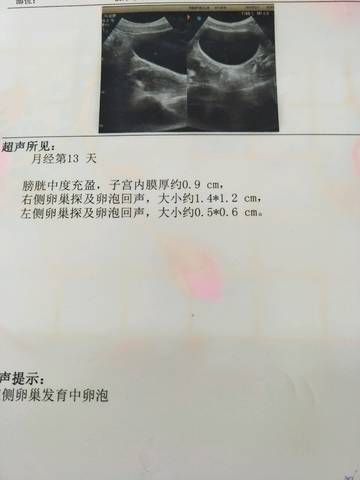 journal_insert_pic_722672145