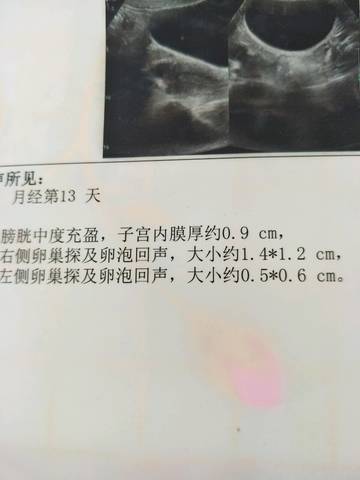 journal_insert_pic_722672122