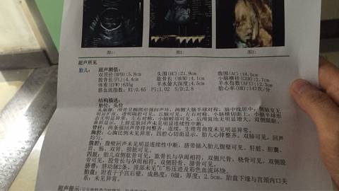 journal_insert_pic_722873023