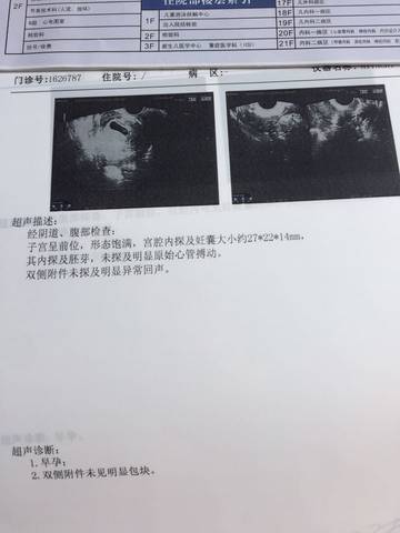journal_insert_pic_722698952