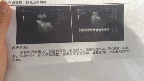 journal_insert_pic_723453803