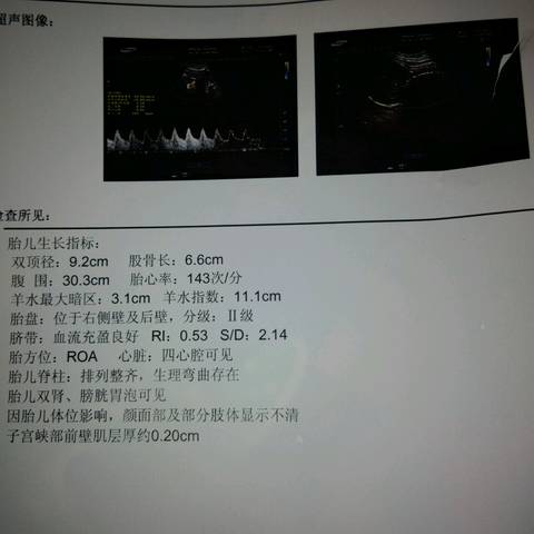 journal_insert_pic_724470950