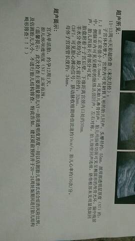 journal_insert_pic_725412059