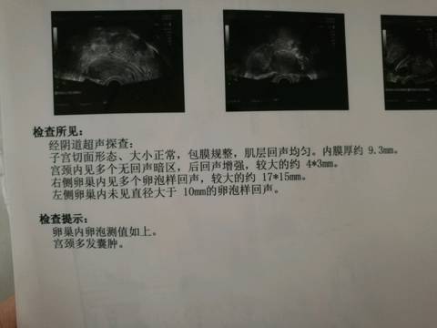 journal_insert_pic_725920321