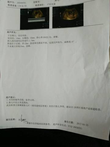 journal_insert_pic_727049464