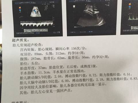 journal_insert_pic_726571243