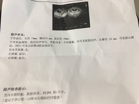 journal_insert_pic_727071728