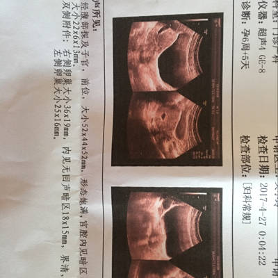journal_insert_pic_728359606