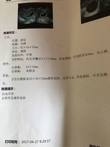 journal_insert_pic_727999133