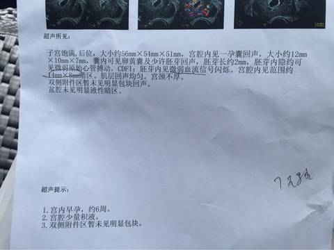 journal_insert_pic_730304169