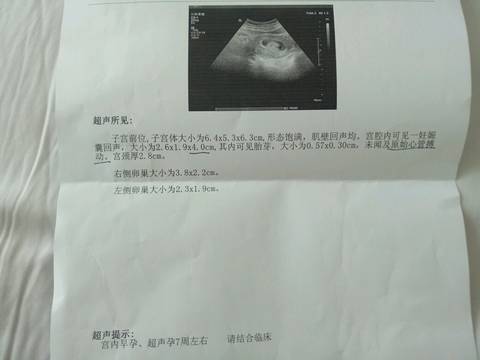 journal_insert_pic_732911501