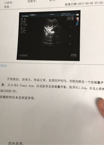 journal_insert_pic_734509980