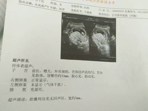 journal_insert_pic_735556787