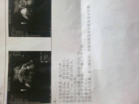journal_insert_pic_737639531