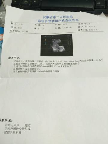 journal_insert_pic_740256167
