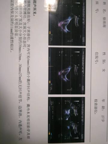 journal_insert_pic_740299609