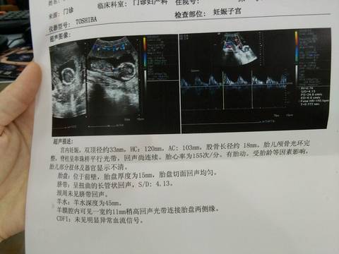 journal_insert_pic_740040850