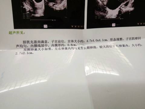 journal_insert_pic_740174383