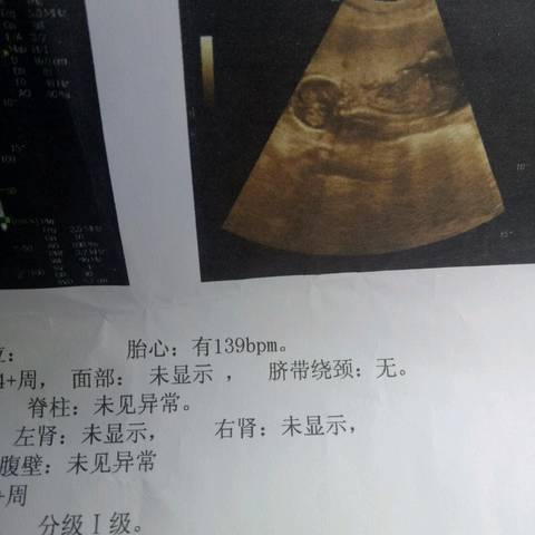 journal_insert_pic_740723050
